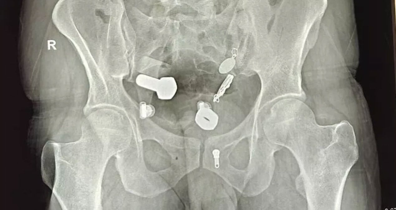 midesi nalbura donmus karin agrisiyla gittigi doktorda gercek ortaya cikti HCAU9nEl.jpg